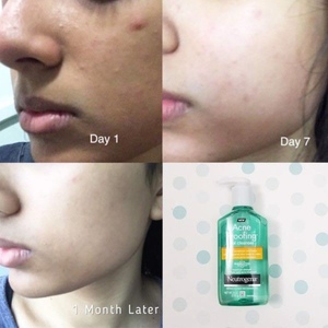 Medium neutrogena acne proofing gel cleanser 170gr